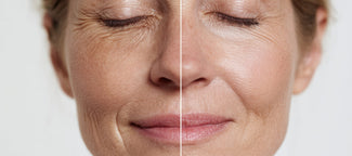 How to Take Bovine Collagen for Best Results — When, How Much, and What to Expect