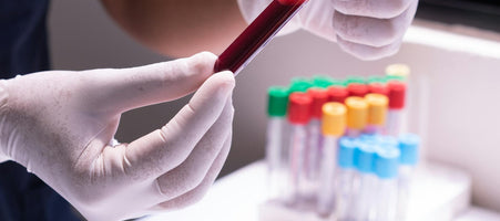 Blood tests for Perimenopause and Menopause